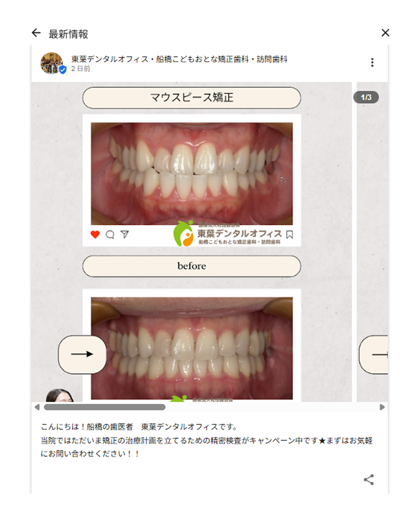 投稿機能（最新情報・お知らせ）の活用